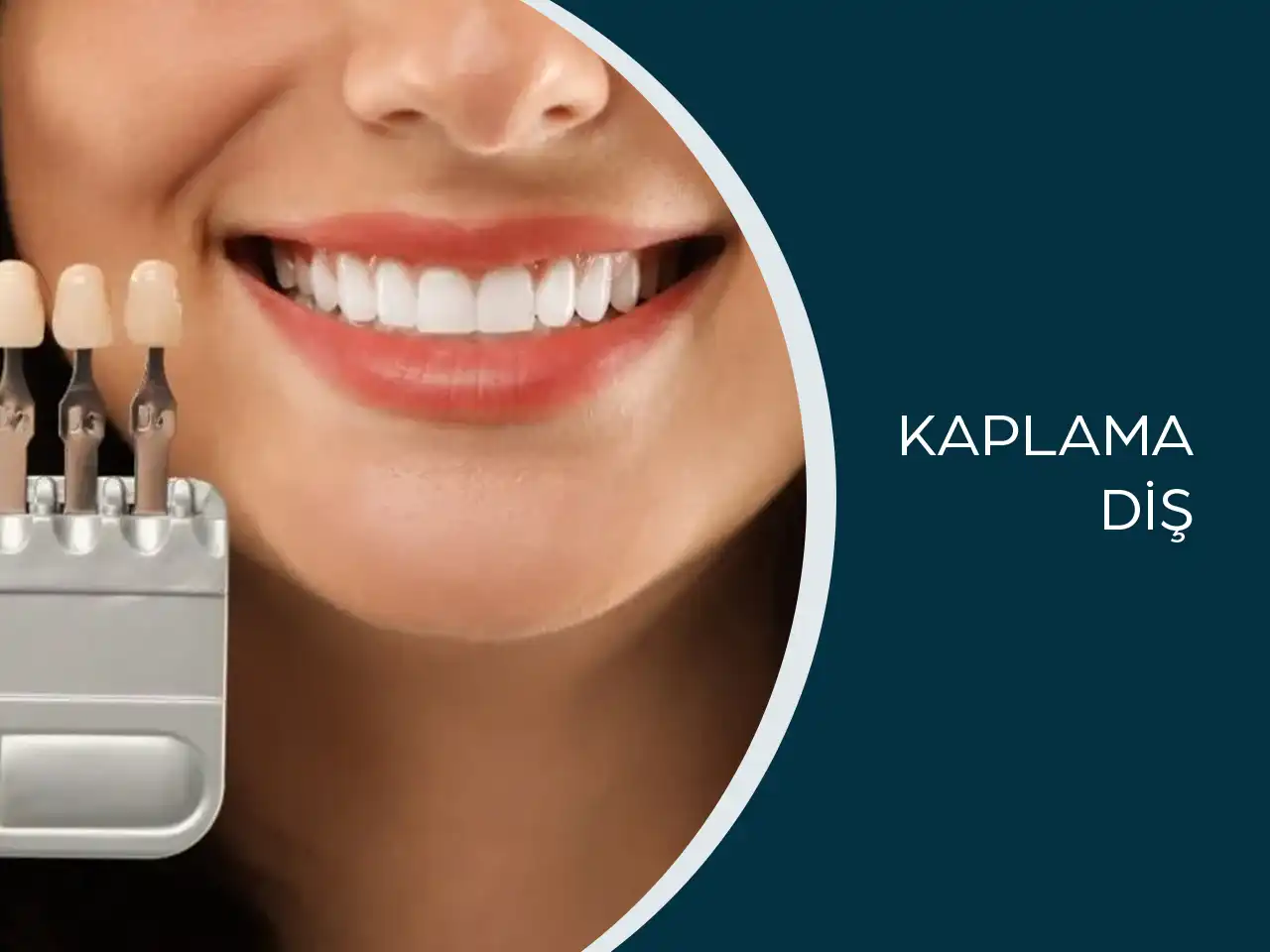 Kaplama Diş