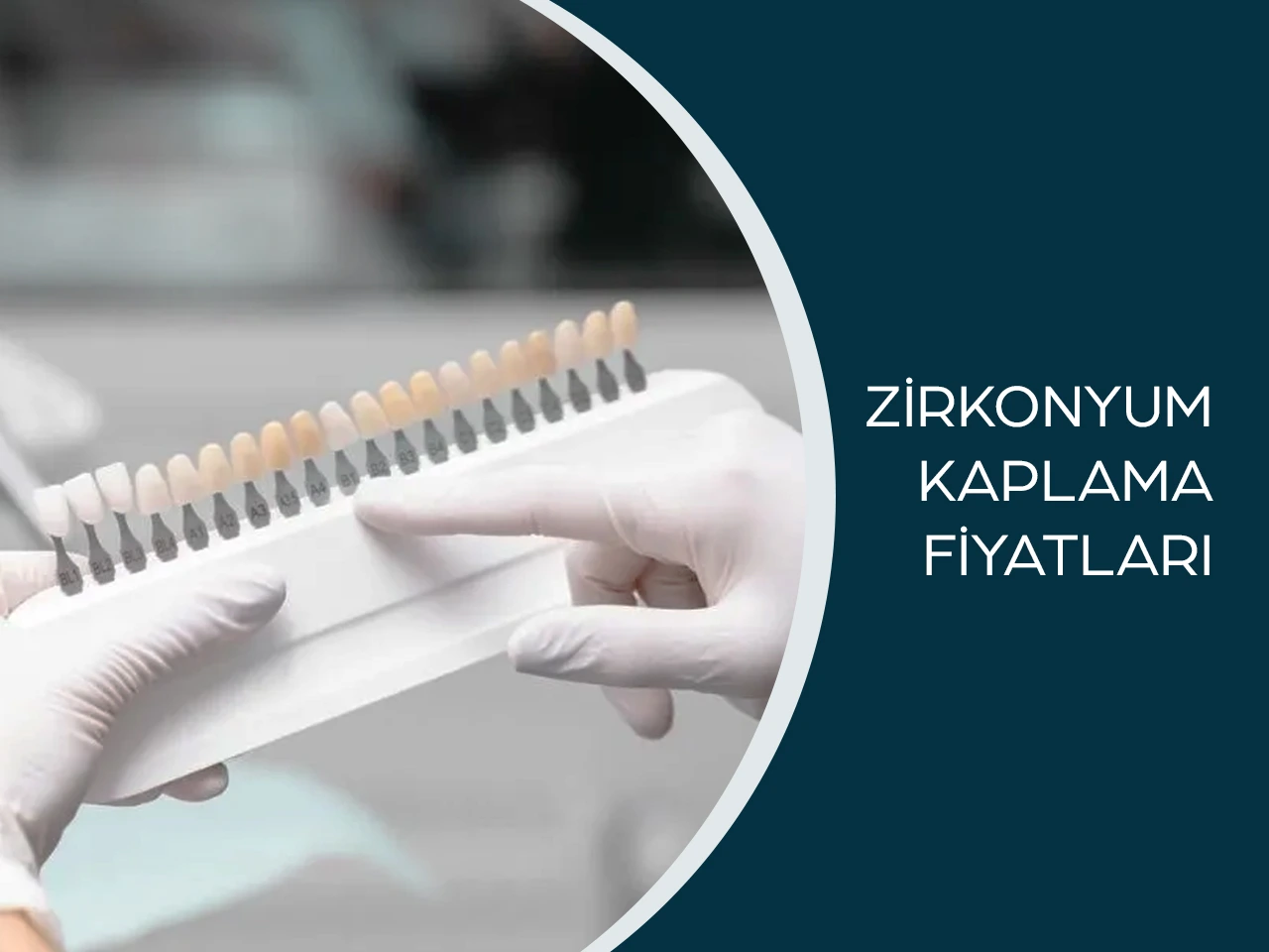 Zirkonyum Kaplama Fiyatları