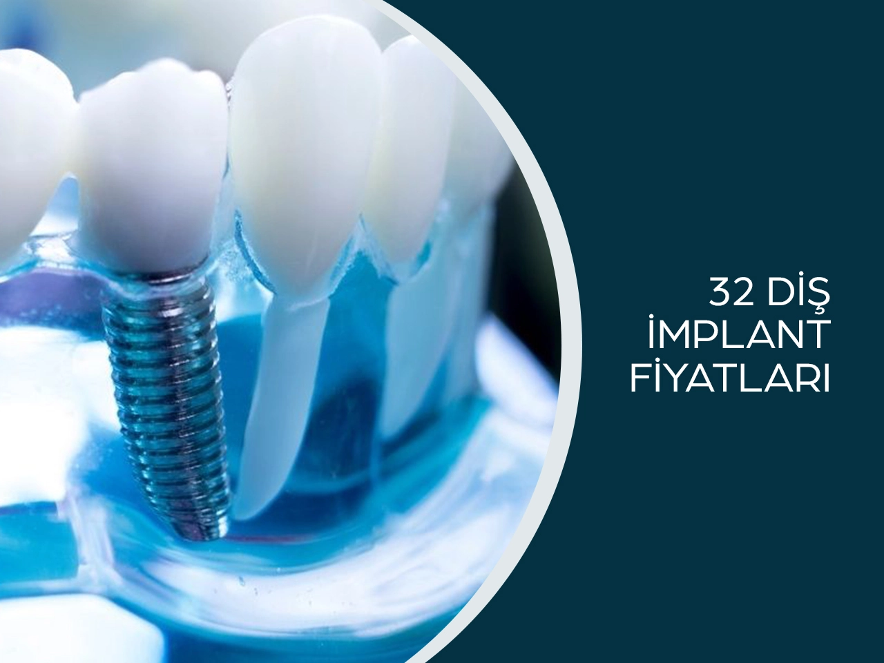 32 Diş İmplant Fiyatları