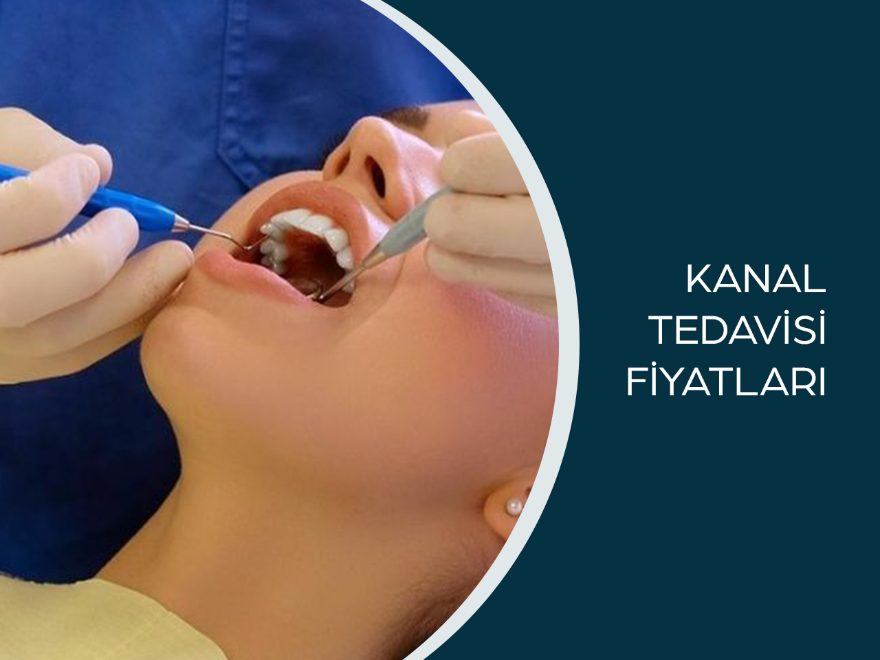 Kanal Tedavisi Fiyatları Sincan