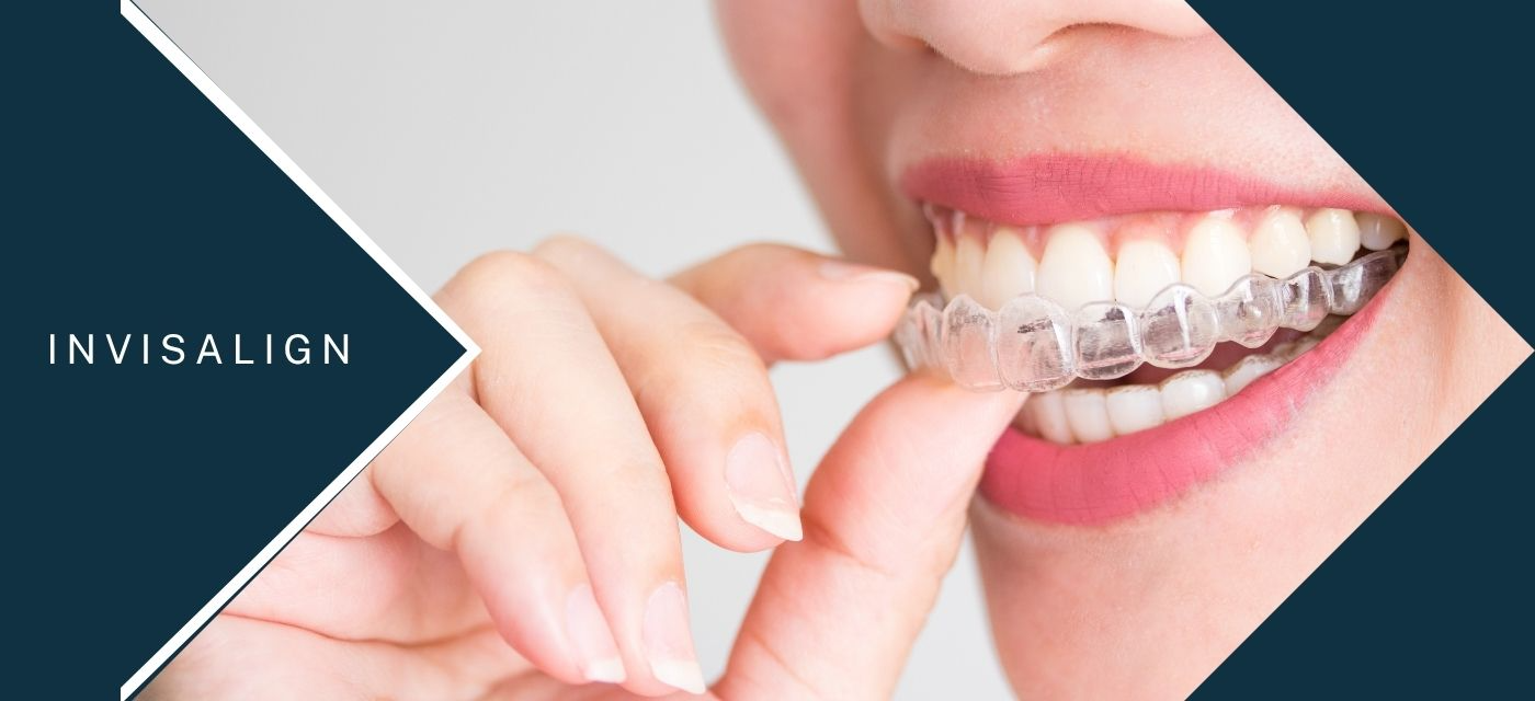 Invisalign Sincan