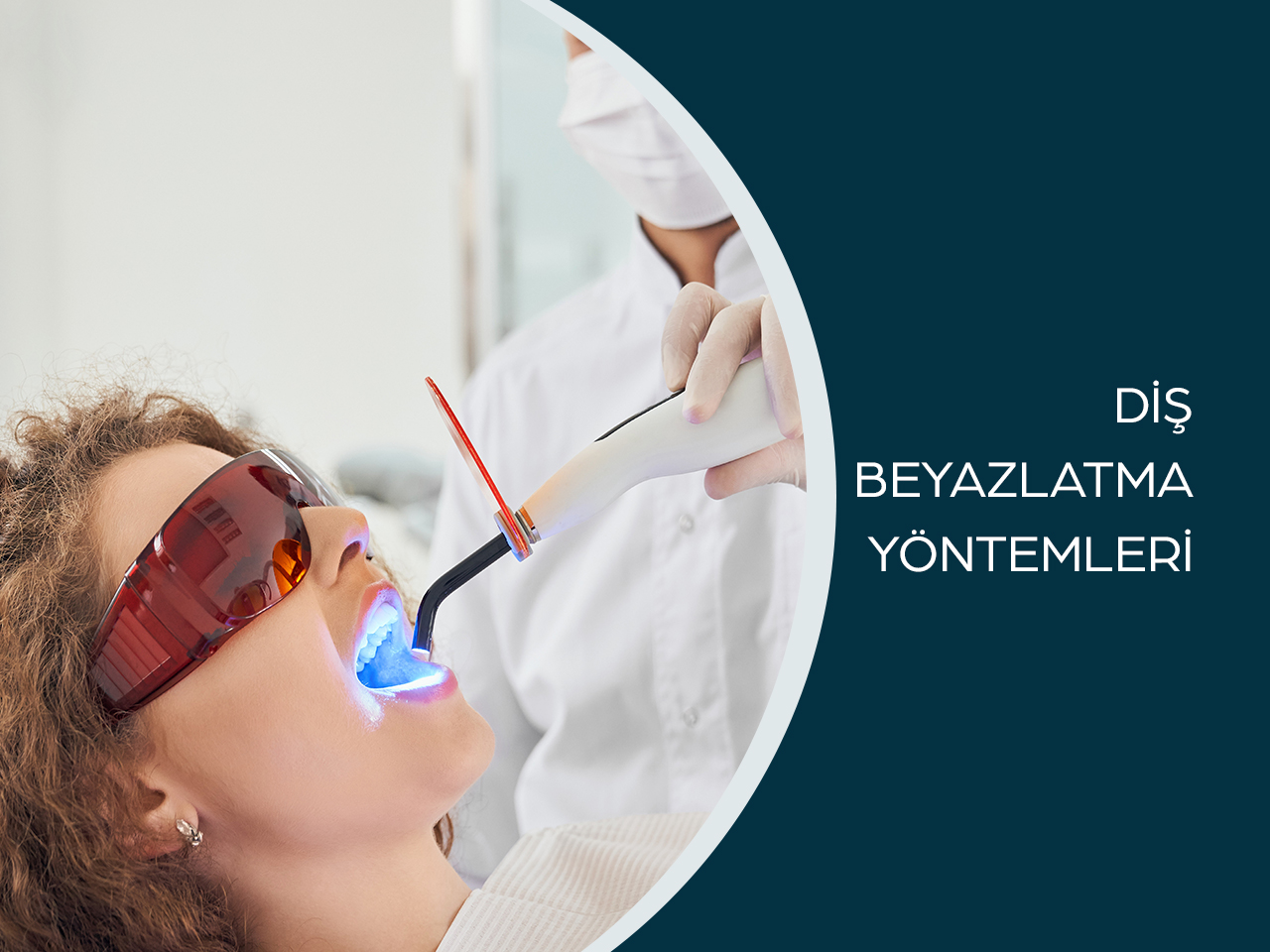 Sincan Diş Beyazlatma Yöntemleri